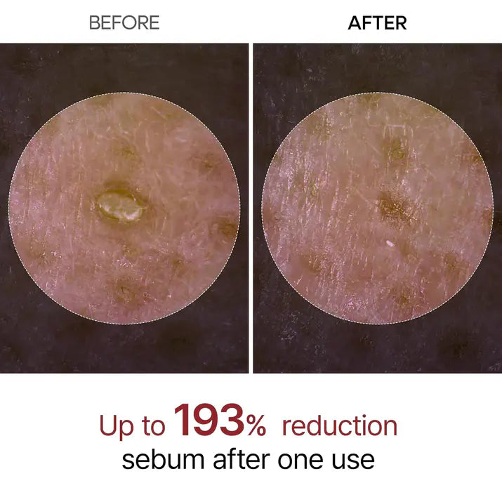 Dr. Melaxin RiceGlow Renewal Brightening Exfoliating Peeling Serum for Radiant Skin